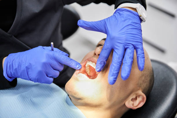 Best Emergency Treatment for Dental Infections or Abscesses in Johnston City, IL